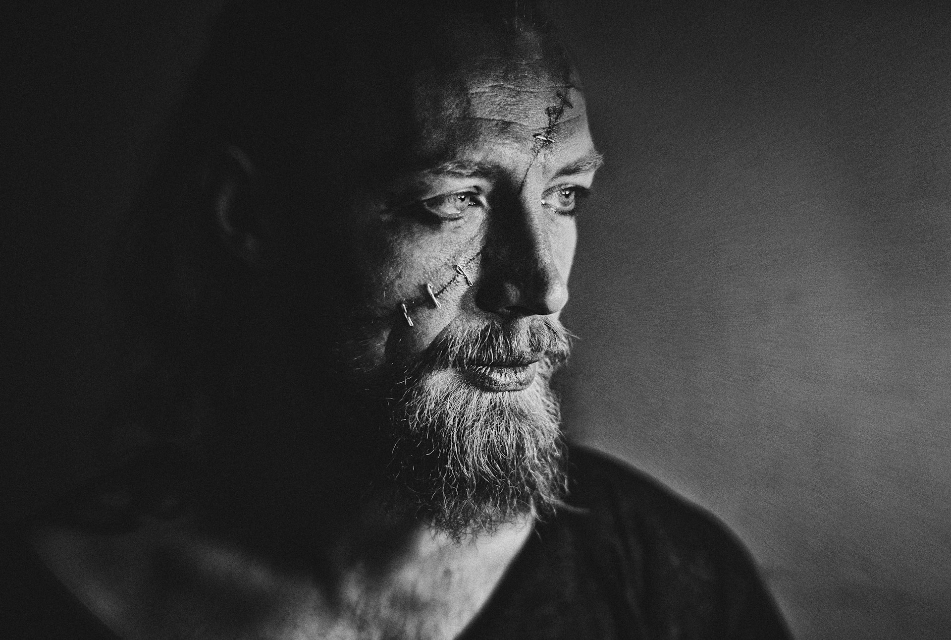 A person with a severe scar across their face.